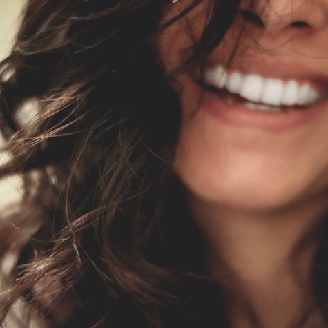 Woman Smiling Dermal Filler 01